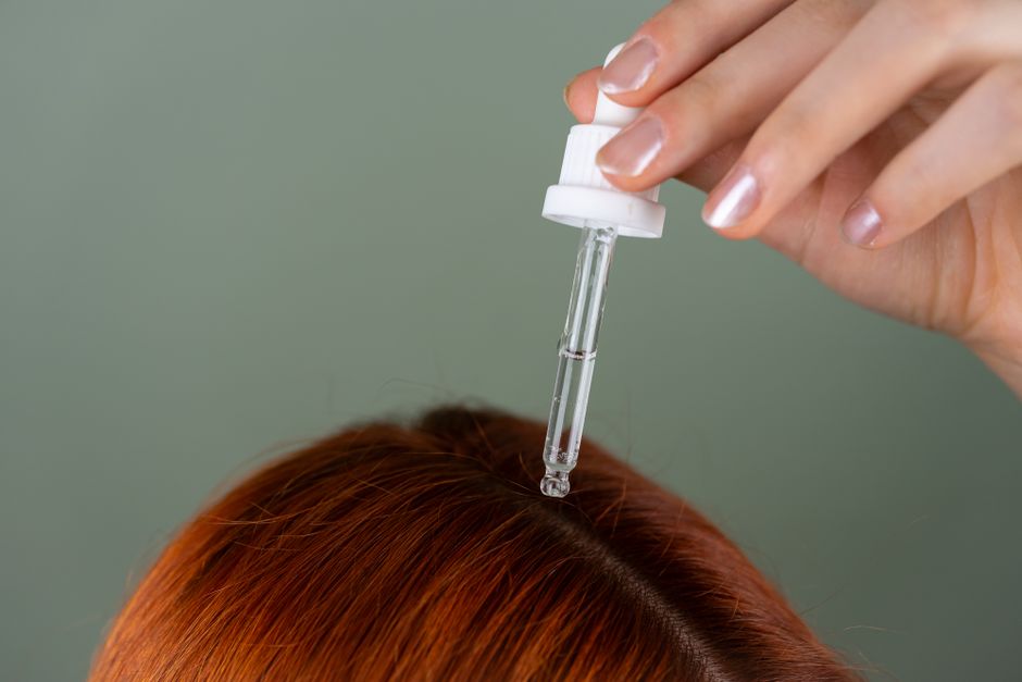 Urzica pentru scalp uscat: calmare și hidratare naturală